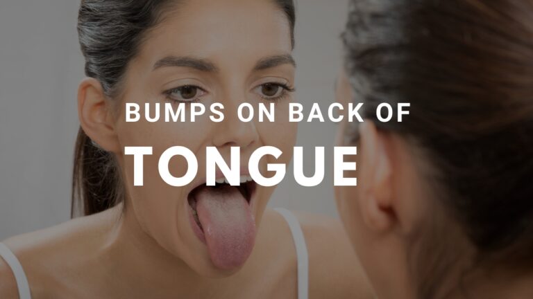 Bumps on Back of Tongue – Causes, Remedies, and Treatments